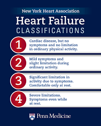 Heart Failure Classification Stages Of Heart Failure And