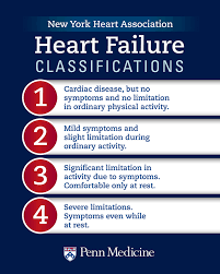 heart failure classification stages of heart failure and