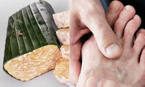 4,426 likes · 96 talking about this. Tidak Semua Orang Bisa Mengonsumsi Tempe Karena Alasan Kesehatan Semua Halaman Grid Health