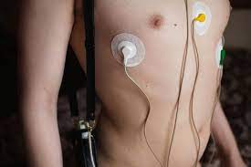 Was Ist Ein Langzeit Ekg Ablauf Dauer Und Vorbereitung
