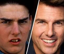 Martin Freeman : L'acteur le mieux payé du monde en 2025