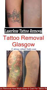 Home Tattoo Removal How Many Sessions To Remove Wrist Tattoo How Can I Remove My Tattoo Without Laser Tattoo Re Tattoo Removal Laser Tattoo Lightening Tattoo