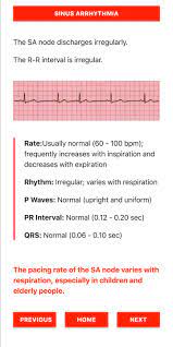 Ecg Flashcards Free For Android Apk Download