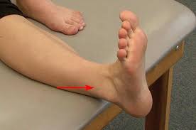 Grade ii sprains are generally more painful and limiting. Sprained Ankle Orthoinfo Aaos