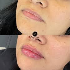 Meet Our Team! Kortney Jones, ARNP Kortney specializes in women's health,  hormone replacement, medical weight loss, vaginal rejuvenation, and medical  aesthetics including filler & Botox. Medical Director and Nurse  Practitioner, Kortney Jones