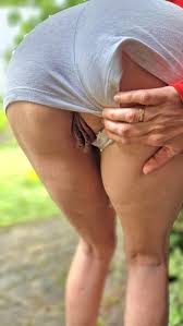 Showing my unusually big lips to the people out there. (f) : rdaresgonewild