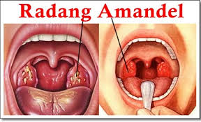 Pin Di Obat Herbal