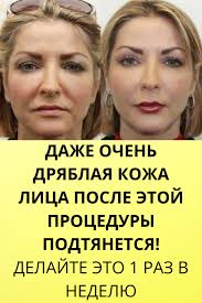 как похудеть после 50 лет без вреда для здоровья Dazhe Ochen Dryablaya Kozha Lica Posle Etoj Procedury Podtyanetsya Delajte Eto 1 Raz V Nedelyu V 2020 G Zdorove Domashnee Lechenie Lico