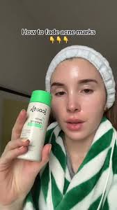 Toner Natalie O Neil