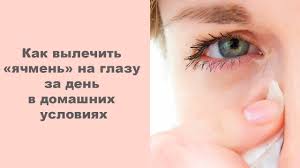 как лечить ячмень на нижнем веке в домашних условиях Kak Lechit Yachmen Na Glazu V Domashnih Usloviyah Narodnymi Sredstvami