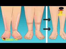 Geschwollene Beine Tipps Gegen Wasser In Den Beinen Youtube Wasser In Den Beinen Geschwollene Beine Lymphdrainage Selber Machen