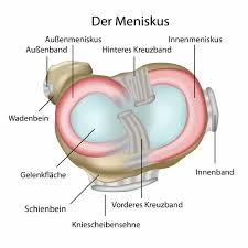 Dafür gibt es künstliche implantate (meniskusprothesen), die am verbleibenden meniskusgewebe fixiert werden. Meniskus Aufbau Und Funktion Im Kniegelenk