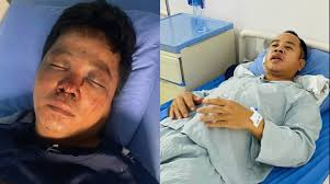 Cái kết cực 'đắng' cho 3 đối tượng đánh 2 anh em giúp người gặp TNGT ở Bắc  Ninh bị thương nặng