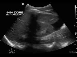 Image result for FAST Exam