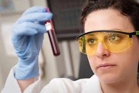 La brizzi distribuzione nasce a roma nel 1974. Rdw Alto Esami Del Sangue Valore Rdw Alto