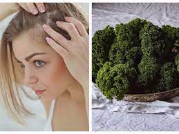 I tried veganism to stop my hair loss. A Trichologist Says Veganism Has Led To An Increase In Hair Loss
