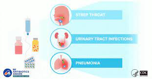 How are ear infections treated? Ear Infection Antibiotic Use Cdc