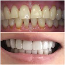 One of new york's top cosmetic dentists and haute living ambassador shares secrets to . Aesthetic Reconstructive Dentistry