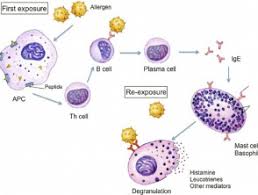 immunoglobulin e tests dermnet nz