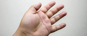 كيف يمكن علاج تورم اليدين ويب طب