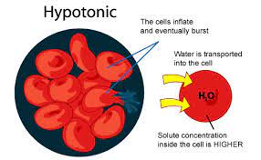 0 45 Nacl Is A Hypotonic Solution Used To Treat Dehydration Solutions Osmotic Pressure Study Tools