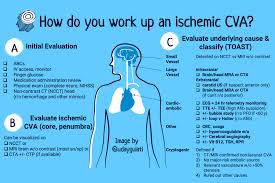 Bildergebnis für CVA