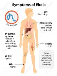Signs and symptoms typically begin abruptly within five to 10 days of infection with ebola virus or marburg virus. Ebola Virus Disease Signs And Symptoms Human Silhouette With Highlighted Internal Organs Royalty Free Cliparts Vectors And Stock Illustration Image 42302803
