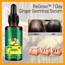 Solve hair loss problems from the root! 7 Days Hair Growth Serum Bottle Rs 999 Piece 3d Om International Id 21520075630