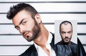 Haircut place for men near you. Hair Replacement Hair Loss Restoration Specialists Tupelo Mississippi