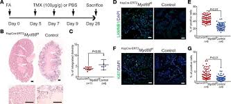This is an online tv channel broadcast from greece. Jci Insight Epithelial Innate Immunity Mediates Tubular Cell Senescence After Kidney Injury