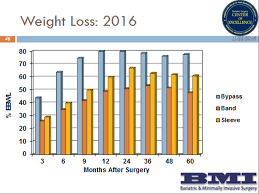 Bmi Surgerys Results Bmisurgery Bariatric Gastric