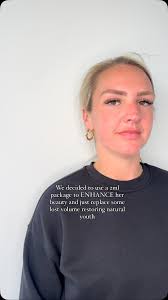 Beautiful natural results are all you will ever find over here 👋 , It’s so  important for us to make sure you still feel like you and your results  actually suit your own profile. It’s not about ...