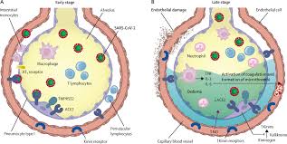 Leave the comments with the games you would like to see at my channel! The Covid 19 Puzzle Deciphering Pathophysiology And Phenotypes Of A New Disease Entity The Lancet Respiratory Medicine