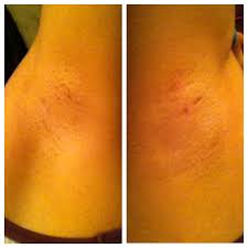 For armpits it is better to use stripless hard wax. Request How Do I Make My Armpits Smooth Again Even After I Shave I Still Feel Little Hairs On My Armpit Thegirlsurvivalguide