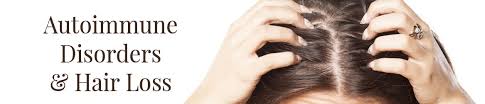 The best way to treat hair loss caused by lupus is to treat the underlying disease—your lupus. Autoimmune Related Hair Loss