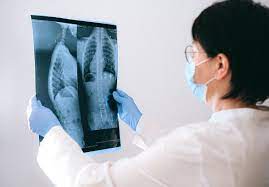 Learn the type, stage and if you have any mutations or biomarkers. 10 Signs You May Have Lung Cancer Rediff Com Get Ahead