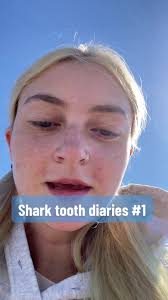 How to Hurt Shark Teeth Cherry Grove Sc