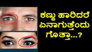 There are also kannada speakers in the indian states of andhra pradesh, maharashtra, tamil nadu, telangana, goa and kerala, and in the usa, singapore, australia, new zealand and canada. à²•à²£ à²£ à²¹ à²° à²¦à²° à²à²¨ à²— à²¤ à²¤ à²¦ à²— à²¤ à²¤ Eye Twitching Kannada Health Tips Youtube