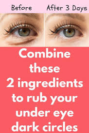 Combine These 2 Ingredients To Rub Your Under Eye Dark Circles Today I Will Share An Excellent Remedy On How To Remove D Undereye Dark Eye Circles Dark Circles