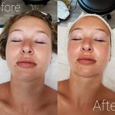 Michelle Swanger (@skinandbareitbeauty) • Instagram photos and videos