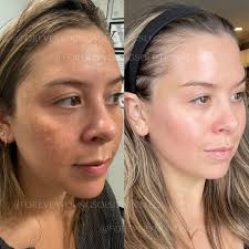 🎁Achieve your best look this holiday season with the power of skincare! As  a trusted leader in ZO Skincare across Northern New England, I'm excited to  offer you a complimentary 20-minute virtual