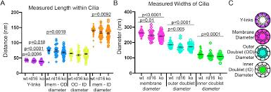 We did not find results for: Superresolution Microscopy Reveals Photoreceptor Specific Subciliary Location And Function Of Cep290 Biorxiv