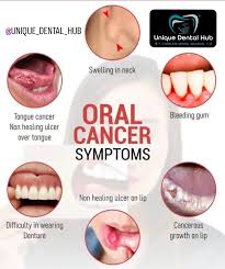 Image result for Oncinotis