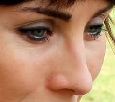 5 Things Thursday {#15}—The Ugly, the Bad, and the Good: A  Trichotillomaniac's Tale