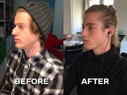 We did not find results for: Sol W Brah On Twitter To Swallow Correctly While Mewing Simply Press The Tongue Firmly Against Your Palate While Swallowing Keep Your Facial Expression Unchanged As You Feel Your Thyroid