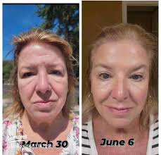 I love korean beauty i live fo