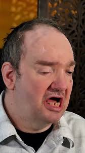 How Animals Have Helped Chris's Memory After a TBI (From Episode 6 of  Bridging the Gap)