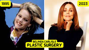 Belinda Carlisle's plastic surgery - Admits having Botox injection