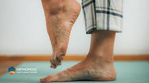 Image result for Foot Drop