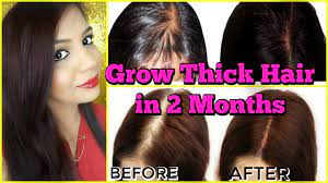 Hair grows from a root at the bottom of a follicle under your skin. Fast Hair Growth Treatment Grow New Hair In 2 Months Superprincessjo Youtube